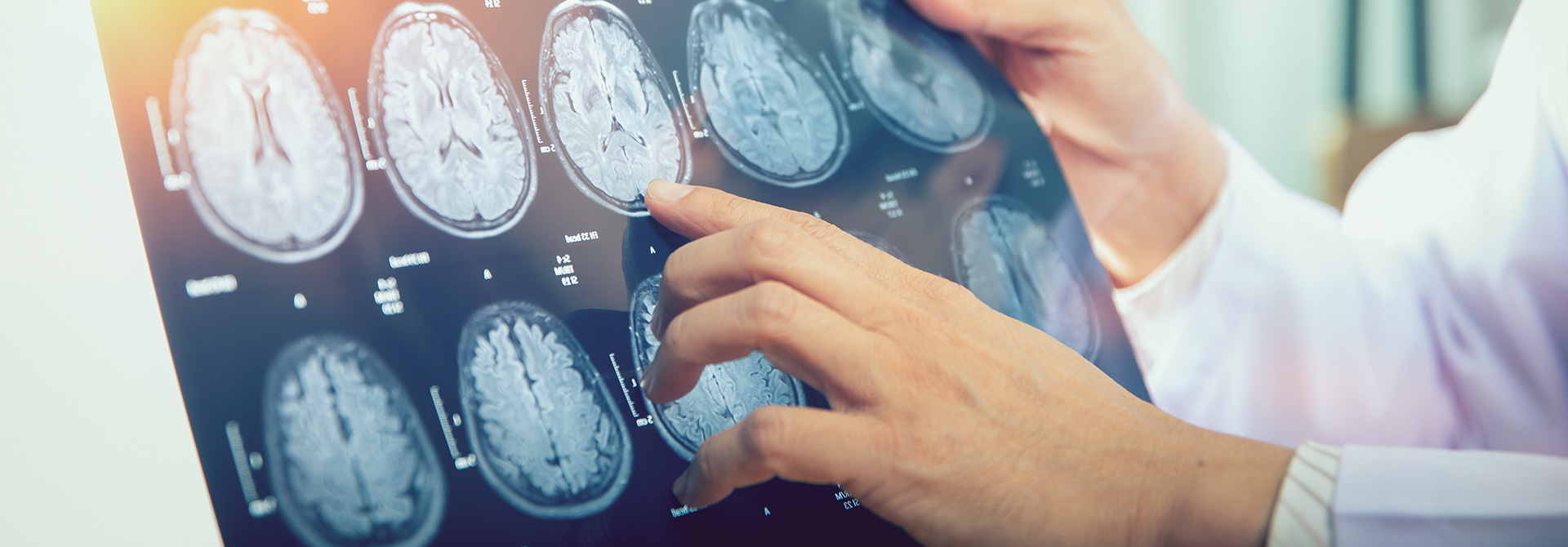 bg brain injury
